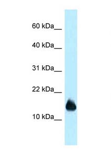 1110059E24Rik Antibody - 1110059E24Rik antibody Western blot of Mouse Heart lysate. Antibody concentration 1 ug/ml.  This image was taken for the unconjugated form of this product. Other forms have not been tested.