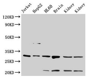 14-3-3 Alpha + Beta Antibody - Western Blot Positive WB detected in: Jurkat whole cell lysate, HepG2 whole cell lysate All lanes: YWHAB antibody at 4µg/ml Secondary Goat polyclonal to rabbit IgG at 1/50000 dilution Predicted band size: 29, 28 kDa Observed band size: 29 kDa