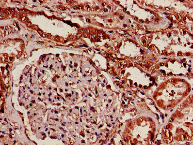 14-3-3 Alpha + Beta Antibody - IHC image of YWHAB Antibody diluted at 1:600 and staining in paraffin-embedded human kidney tissue performed on a Leica BondTM system. After dewaxing and hydration, antigen retrieval was mediated by high pressure in a citrate buffer (pH 6.0). Section was blocked with 10% normal goat serum 30min at RT. Then primary antibody (1% BSA) was incubated at 4°C overnight. The primary is detected by a biotinylated secondary antibody and visualized using an HRP conjugated SP system.