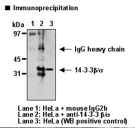 14-3-3 Beta + Sigma Antibody