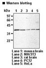 14-3-3 Beta + Sigma Antibody