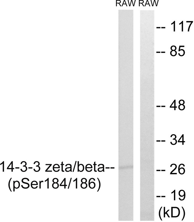 14-3-3 Beta + Zeta Antibody - Western blot analysis of lysates from RAW264.7 cells treated with UV 15', using 14-3-3 beta/zeta (Phospho-Ser184/186) Antibody. The lane on the right is blocked with the phospho peptide.