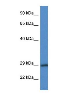 15-PGDH / HPGD Antibody - HPGD / 15-PGDH antibody Western blot of 435S Cell lysate. Antibody concentration 1 ug/ml.  This image was taken for the unconjugated form of this product. Other forms have not been tested.