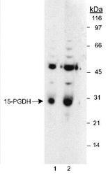 15-PGDH / HPGD Antibody - Detection of 15-PGDH in LoVo whole cell lysates. Lane 1 uses a 1:6,000 dilution. Lane 2 uses a 1:1,500 dilution. ECL: 10 second exposure.  This image was taken for the unconjugated form of this product. Other forms have not been tested.