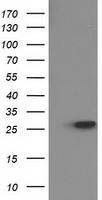 15-PGDH / HPGD Antibody - HEK293T cells were transfected with the pCMV6-ENTRY control (Left lane) or pCMV6-ENTRY HPGD (Right lane) cDNA for 48 hrs and lysed. Equivalent amounts of cell lysates (5 ug per lane) were separated by SDS-PAGE and immunoblotted with anti-HPGD.