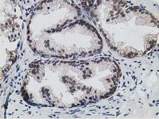 15-PGDH / HPGD Antibody - IHC of paraffin-embedded Human prostate tissue using anti-HPGD mouse monoclonal antibody. (Heat-induced epitope retrieval by 10mM citric buffer, pH6.0, 100C for 10min).