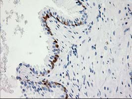 15-PGDH / HPGD Antibody - IHC of paraffin-embedded Human prostate tissue using anti-HPGD mouse monoclonal antibody.