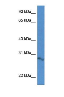 2610034B18Rik Antibody - 2610034B18Rik antibody Western blot of Mouse Spleen lysate. Antibody concentration 1 ug/ml.  This image was taken for the unconjugated form of this product. Other forms have not been tested.