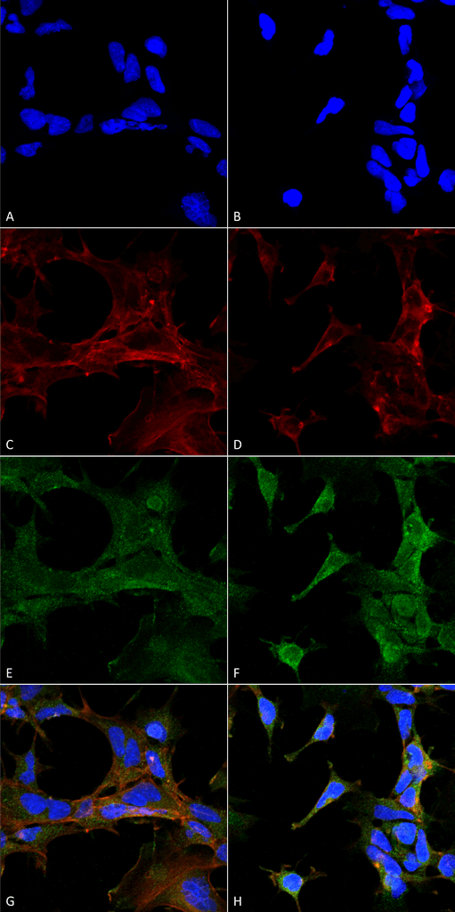 4-HNE Antibody - Immunocytochemistry/Immunofluorescence analysis using Mouse Anti-4-Hydroxy-2-hexenal Monoclonal Antibody, Clone 6F10. Tissue: Embryonic kidney epithelial cell line (HEK293). Species: Human. Fixation: 5% Formaldehyde for 5 min. Primary Antibody: Mouse Anti-4-Hydroxy-2-hexenal Monoclonal Antibody  at 1:400 for 30-60 min at RT. Secondary Antibody: Goat Anti-Mouse Alexa Fluor 488 at 1:1500 for 30-60 min at RT. Counterstain: Phalloidin Alexa Fluor 633 F-Actin stain; DAPI (blue) nuclear stain at 1:250, 1:50000 for 30-60 min at RT. Magnification: 20X (2X Zoom). (A,C,E,G) - Untreated. (B,D,F,H) - Cells cultured overnight with 50 µM H2O2. (A,B) DAPI (blue) nuclear stain. (C,D) Phalloidin Alexa Fluor 633 F-Actin stain. (E,F) 4-Hydroxy-2-hexenal Antibody. (G,H) Composite. Courtesy of: Dr. Robert Burke, University of Victoria.