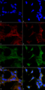 4-HNE Antibody - Immunocytochemistry/Immunofluorescence analysis using Mouse Anti-4-Hydroxy-2-hexenal Monoclonal Antibody, Clone 6F10. Tissue: Embryonic kidney epithelial cell line (HEK293). Species: Human. Fixation: 5% Formaldehyde for 5 min. Primary Antibody: Mouse Anti-4-Hydroxy-2-hexenal Monoclonal Antibody  at 1:400 for 30-60 min at RT. Secondary Antibody: Goat Anti-Mouse Alexa Fluor 488 at 1:1500 for 30-60 min at RT. Counterstain: Phalloidin Alexa Fluor 633 F-Actin stain; DAPI (blue) nuclear stain at 1:250, 1:50000 for 30-60 min at RT. Magnification: 20X (2X Zoom). (A,C,E,G) - Untreated. (B,D,F,H) - Cells cultured overnight with 50 µM H2O2. (A,B) DAPI (blue) nuclear stain. (C,D) Phalloidin Alexa Fluor 633 F-Actin stain. (E,F) 4-Hydroxy-2-hexenal Antibody. (G,H) Composite. Courtesy of: Dr. Robert Burke, University of Victoria.