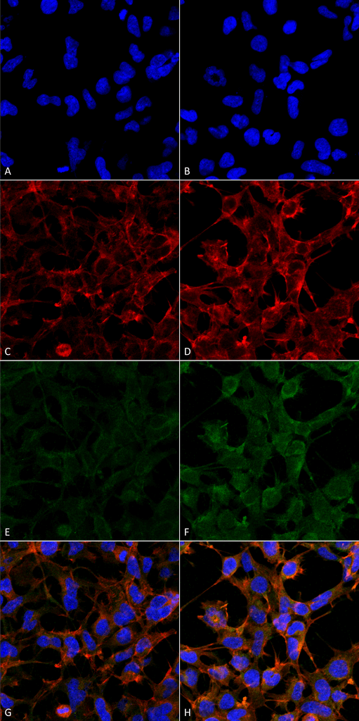 4-Hydroxynonenal Antibody - Immunocytochemistry/Immunofluorescence analysis using Mouse Anti-4-Hydroxynonenal Monoclonal Antibody, Clone 12F7. Tissue: Embryonic kidney epithelial cell line (HEK293). Species: Human. Fixation: 5% Formaldehyde for 5 min. Primary Antibody: Mouse Anti-4-Hydroxynonenal Monoclonal Antibody  at 1:50 for 30-60 min at RT. Secondary Antibody: Goat Anti-Mouse Alexa Fluor 488 at 1:1500 for 30-60 min at RT. Counterstain: Phalloidin Alexa Fluor 633 F-Actin stain; DAPI (blue) nuclear stain at 1:250, 1:50000 for 30-60 min at RT. Magnification: 20X (2X Zoom). (A,C,E,G) - Untreated. (B,D,F,H) - Cells cultured overnight with 50 µM H2O2. (A,B) DAPI (blue) nuclear stain. (C,D) Phalloidin Alexa Fluor 633 F-Actin stain. (E,F) 4-Hydroxynonenal Antibody. (G,H) Composite. Courtesy of: Dr. Robert Burke, University of Victoria.