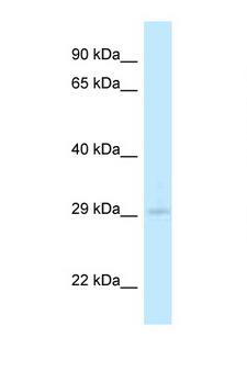 4933408B17Rik Antibody - 4933408B17Rik antibody Western blot of Mouse Spleen lysate. Antibody concentration 1 ug/ml.  This image was taken for the unconjugated form of this product. Other forms have not been tested.