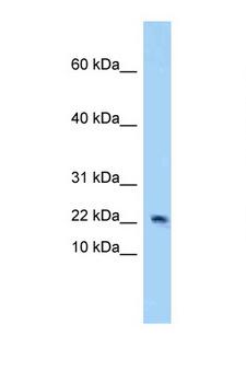 4E-BP2 / EIF4EBP2 Antibody - EIF4EBP2 / 4EBP2 antibody Western blot of Mouse Heart lysate. Antibody concentration 1 ug/ml.  This image was taken for the unconjugated form of this product. Other forms have not been tested.