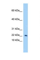 4E-BP2 / EIF4EBP2 Antibody - EIF4EBP2 / 4EBP2 antibody Western blot of Mouse Heart lysate. Antibody concentration 1 ug/ml.  This image was taken for the unconjugated form of this product. Other forms have not been tested.