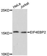 4E-BP2 / EIF4EBP2 Antibody - Western blot analysis of extracts of various cell lines, using EIF4EBP2 antibody at 1:3000 dilution. The secondary antibody used was an HRP Goat Anti-Rabbit IgG (H+L) at 1:10000 dilution. Lysates were loaded 25ug per lane and 3% nonfat dry milk in TBST was used for blocking. An ECL Kit was used for detection and the exposure time was 90s.