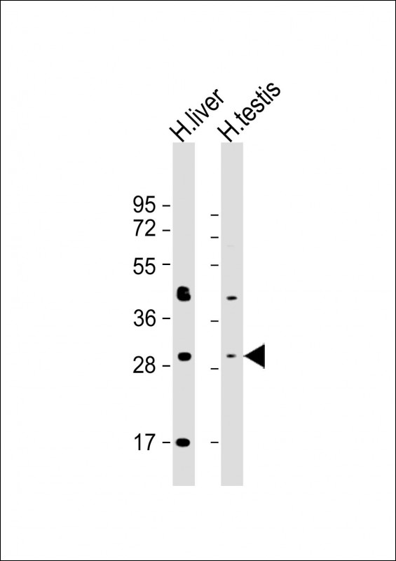 5-Alpha Reductase / SRD5A1 Antibody - All lanes: Anti-SRD5A1 Antibody (Center) at 1:8000 dilution Lane 1: human liver lysate Lane 2: human testis lysate Lysates/proteins at 20 µg per lane. Secondary Goat Anti-Rabbit IgG, (H+L), Peroxidase conjugated at 1/10000 dilution. Predicted band size: 29 kDa Blocking/Dilution buffer: 5% NFDM/TBST.