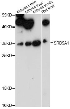 5-Alpha Reductase / SRD5A1 Antibody - Western blot analysis of extracts of various cell lines, using SRD5A1 antibody at 1:1000 dilution. The secondary antibody used was an HRP Goat Anti-Rabbit IgG (H+L) at 1:10000 dilution. Lysates were loaded 25ug per lane and 3% nonfat dry milk in TBST was used for blocking. An ECL Kit was used for detection and the exposure time was 90s.