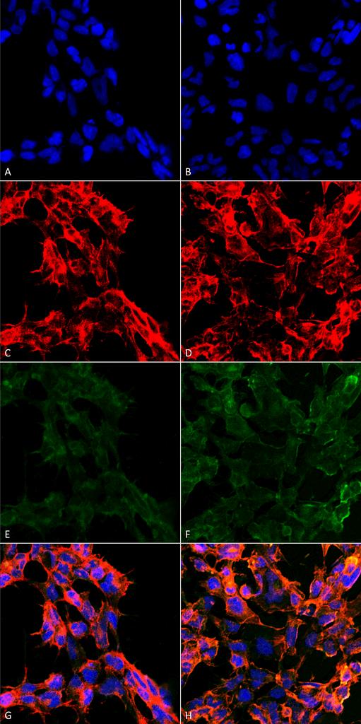 7-Ketocholesterol Antibody - Immunocytochemistry/Immunofluorescence analysis using Mouse Anti-7-Ketocholesterol Monoclonal Antibody, Clone 3F7. Tissue: Embryonic kidney epithelial cell line (HEK293). Species: Human. Fixation: 5% Formaldehyde for 5 min. Primary Antibody: Mouse Anti-7-Ketocholesterol Monoclonal Antibody at 1:50 for 30-60 min at RT. Secondary Antibody: Goat Anti-Mouse Alexa Fluor 488 at 1:1500 for 30-60 min at RT. Counterstain: Phalloidin Alexa Fluor 633 F-Actin stain; DAPI (blue) nuclear stain at 1:250, 1:50000 for 30-60 min at RT. Magnification: 20X (2X Zoom). (A,C,E,G) - Untreated. (B,D,F,H) - Cells cultured overnight with 50 µM H2O2. (A,B) DAPI (blue) nuclear stain. (C,D) Phalloidin Alexa Fluor 633 F-Actin stain. (E,F) 7-Ketocholesterol Antibody. (G,H) Composite. Courtesy of: Dr. Robert Burke, University of Victoria.