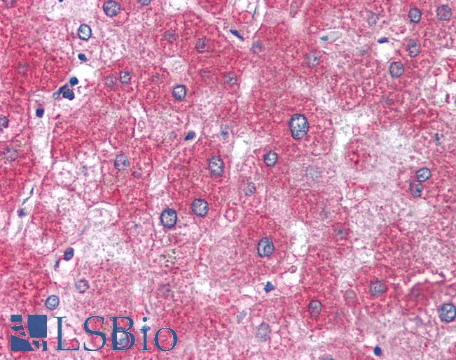 A1BG Antibody - Human Liver (formalin-fixed, paraffin-embedded) stained with A1BG antibody LS-B1507 at 5 ug/ml followed by biotinylated goat anti-rabbit IgG secondary antibody, alkaline phosphatase-streptavidin and chromogen.  This image was taken for the unconjugated form of this product. Other forms have not been tested.