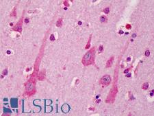 A1BG Antibody - Anti-A1BG antibody IHC of human brain, cortex. Immunohistochemistry of formalin-fixed, paraffin-embedded tissue after heat-induced antigen retrieval. Antibody concentration 5 ug/ml.  This image was taken for the unconjugated form of this product. Other forms have not been tested.