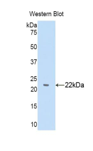 A1BG Antibody - Western blot of recombinant A1BG / GAB.  This image was taken for the unconjugated form of this product. Other forms have not been tested.