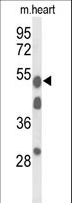 A1BG Antibody - Western blot of A1BG Antibody in mouse heart tissue lysates (35 ug/lane). A1BG (arrow) was detected using the purified antibody.