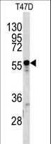 A1BG Antibody - Western blot of A1BG antibody in T47D cell line lysates (35 ug/lane). A1BG (arrow) was detected using the purified antibody.