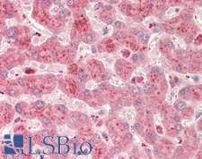 A1BG Antibody - Human Liver: Formalin-Fixed, Paraffin-Embedded (FFPE).  This image was taken for the unconjugated form of this product. Other forms have not been tested.