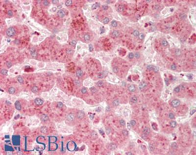 A1BG Antibody - Human Liver: Formalin-Fixed, Paraffin-Embedded (FFPE).  This image was taken for the unconjugated form of this product. Other forms have not been tested.