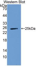 A1BG Antibody - Western Blot; Sample: Recombinant a1BG, Human.