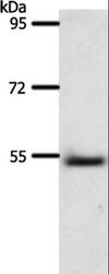 A1BG Antibody - Western blot analysis of Human liver cancer tissue, using A1BG Polyclonal Antibody at dilution of 1:500.