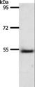 A1BG Antibody - Western blot analysis of Human liver cancer tissue, using A1BG Polyclonal Antibody at dilution of 1:500.