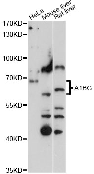 A1BG Antibody - Western blot analysis of extracts of various cell lines, using A1BG antibody at 1:3000 dilution. The secondary antibody used was an HRP Goat Anti-Rabbit IgG (H+L) at 1:10000 dilution. Lysates were loaded 25ug per lane and 3% nonfat dry milk in TBST was used for blocking. An ECL Kit was used for detection and the exposure time was 90s.