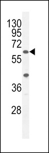 A1CF / ACF Antibody - ACF Antibody western blot of A375 cell line lysates (35 ug/lane). The ACF antibody detected the ACF protein (arrow).
