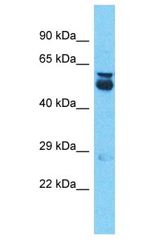 A1CF / ACF Antibody - A1CF / ACF antibody Western Blot of Liver Tumor. Antibody dilution: 1 ug/ml.  This image was taken for the unconjugated form of this product. Other forms have not been tested.