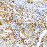 A1CF / ACF Antibody - Immunohistochemistry of paraffin-embedded Rat ovary using A1CF Polyclonal Antibody at dilution of 1:100 (40x lens).