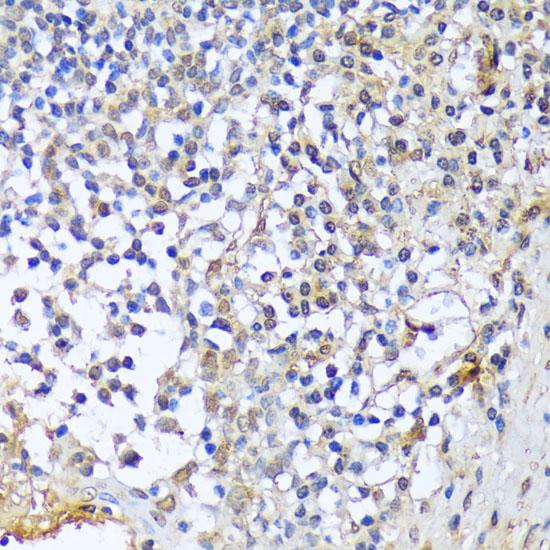 A1CF / ACF Antibody - Immunohistochemistry of paraffin-embedded Human tonsil using A1CF Polyclonal Antibody at dilution of 1:100 (40x lens).