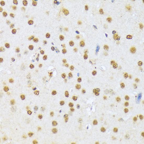 A1CF / ACF Antibody - Immunohistochemistry of paraffin-embedded Mouse brain using A1CF Polyclonal Antibody at dilution of 1:100 (40x lens).