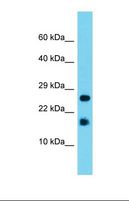 A2LD1 Antibody - Western blot of Mouse Liver. A2ld1 antibody dilution 1.0 ug/ml.  This image was taken for the unconjugated form of this product. Other forms have not been tested.
