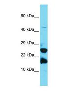A2LD1 Antibody - Western blot of A2LD1 Antibody - N-terminal region with human Jurkat cells lysate.  This image was taken for the unconjugated form of this product. Other forms have not been tested.