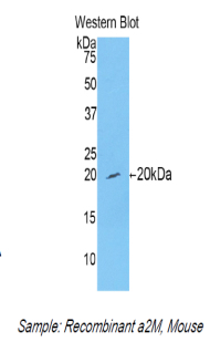 A2M / Alpha-2-Macroglobulin Antibody - Western blot of recombinant Alpha-2-Macroglobulin / A2M.  This image was taken for the unconjugated form of this product. Other forms have not been tested.