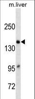 A2M / Alpha-2-Macroglobulin Antibody - A2M Antibody (Ascites)western blot of mouse Liver tissue lysates (35 ug/lane). The A2M antibody detected the A2M protein (arrow).