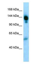 A2M / Alpha-2-Macroglobulin Antibody - Alpha-2-Macroglobulin / A2M antibody Western Blot of Human skin.  This image was taken for the unconjugated form of this product. Other forms have not been tested.