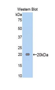 A2M / Alpha-2-Macroglobulin Antibody - Western blot of recombinant Alpha-2-Macroglobulin / A2M.  This image was taken for the unconjugated form of this product. Other forms have not been tested.