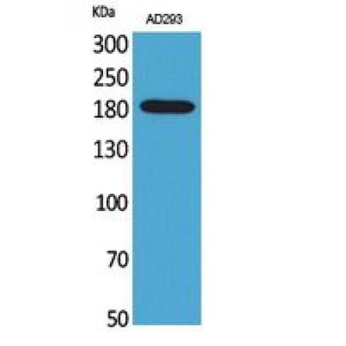 A2M / Alpha-2-Macroglobulin Antibody - Western blot of Macroglobulin alpha-2 antibody