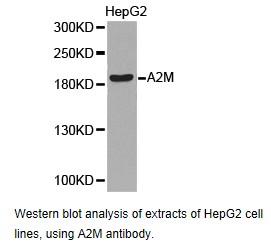 A2M / Alpha-2-Macroglobulin Antibody - Western blot.
