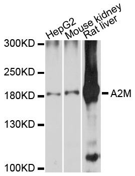 A2M / Alpha-2-Macroglobulin Antibody - Western blot analysis of extracts of various cell lines.