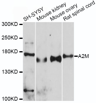 A2M / Alpha-2-Macroglobulin Antibody - Western blot analysis of extracts of various cell lines, using A2M antibody at 1:500 dilution. The secondary antibody used was an HRP Goat Anti-Rabbit IgG (H+L) at 1:10000 dilution. Lysates were loaded 25ug per lane and 3% nonfat dry milk in TBST was used for blocking. An ECL Kit was used for detection and the exposure time was 60s.