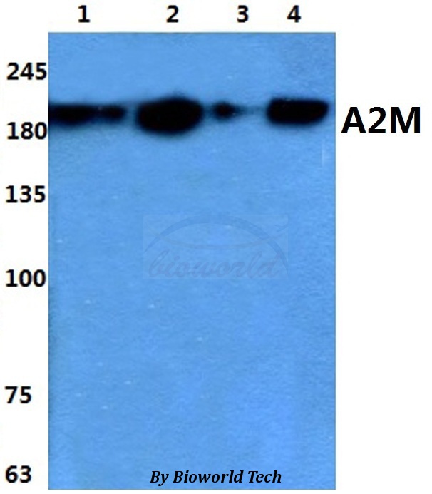 A2M / Alpha-2-Macroglobulin Antibody - Western blot of A2M antibody at 1:500 dilution. Lane 1: HEK293T whole cell lysate. Lane 2: Raw264.7 whole cell lysate. Lane 3: NIH-3T3 whole cell lysate. Lane 4: PC12 whole cell lysate.