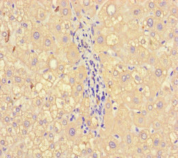 A2M / Alpha-2-Macroglobulin Antibody - Immunohistochemistry of paraffin-embedded human liver tissue at dilution of 1:100